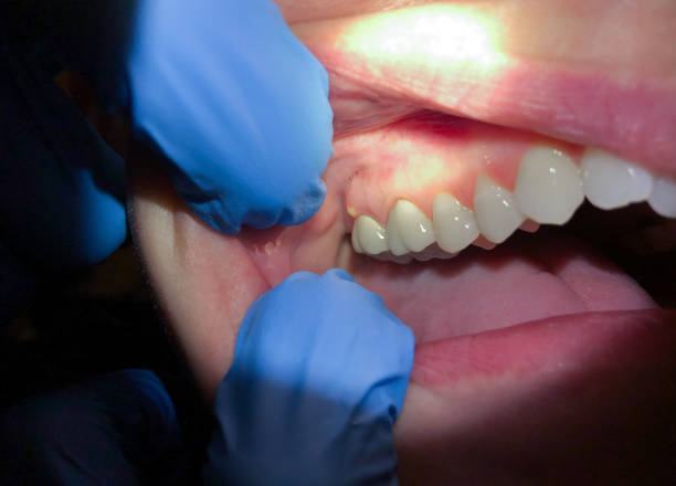 Best Emergency Broken Tooth Repair in Parks, AZ